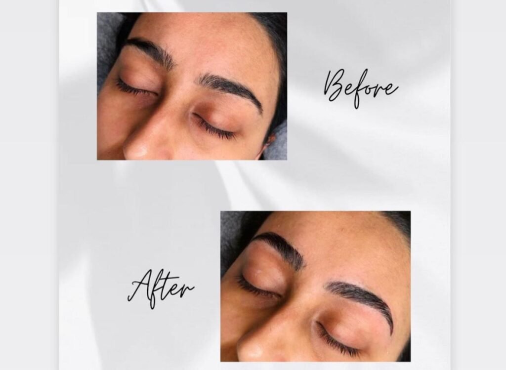 Burnaby Laser & Beauty Spa | Skin Care Experts & Hair Removal Specialists